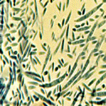 micro and macro conidia of bakane disease